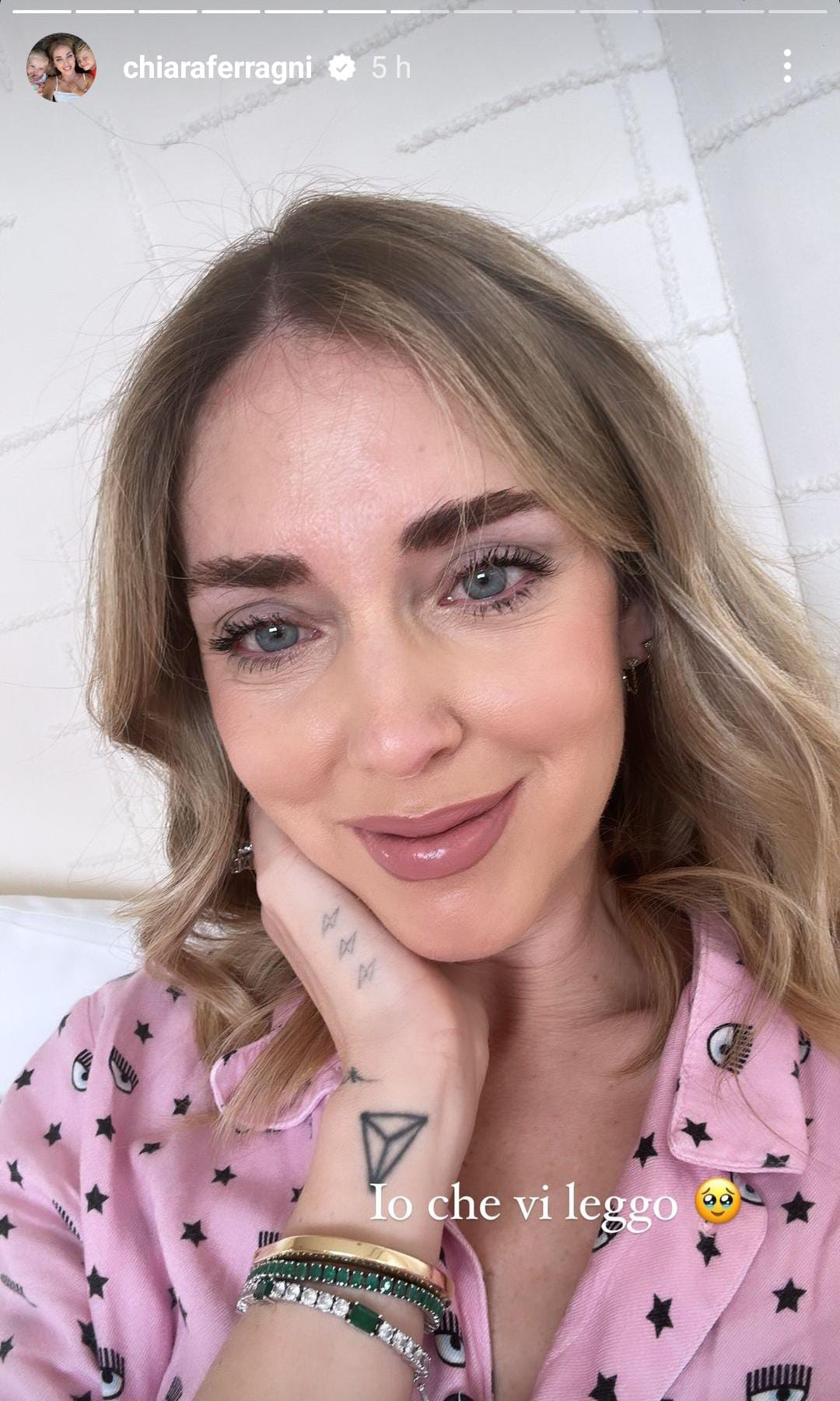 Chiara Ferragni si rivela su Instagram con gli Occhi Lucidi